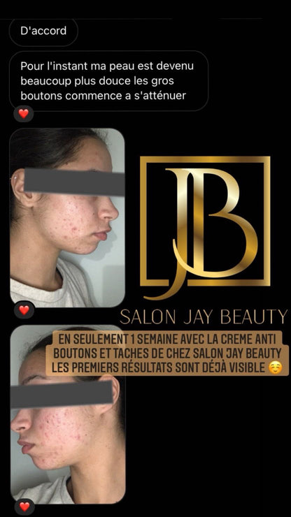 Crème anti boutons et taches